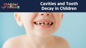 Cavities and Tooth Decay in Children