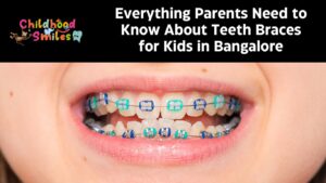 Everything Parents Need to Know About Teeth Braces for Kids in Bangalore