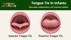 Tongue Tie In Infants Early Signs, Complications, and Treatment Options