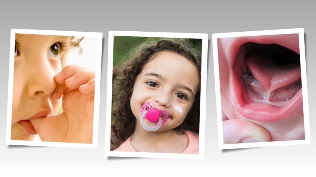 Habits and Problems that may affect your child's future oral development