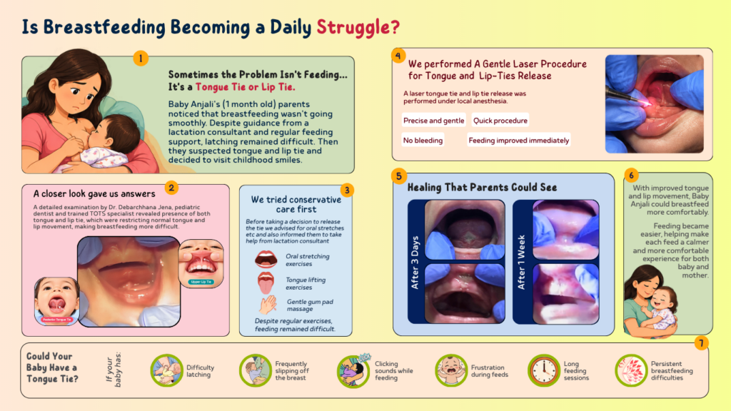 Childhood Smiles - Tongue-Tie and Lip Tie Treatment for children in Banglore
