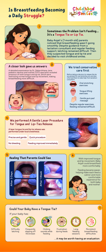 Patient Story - Childhood Smiles - Is Breastfeeding Becoming a Daily Struggle